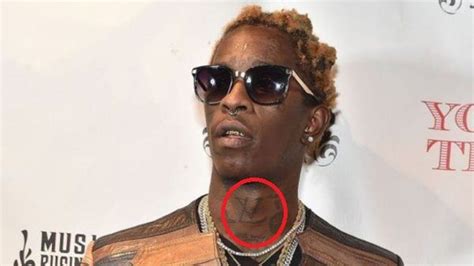 ysl tattoo removed|young thug ysl tattoo.